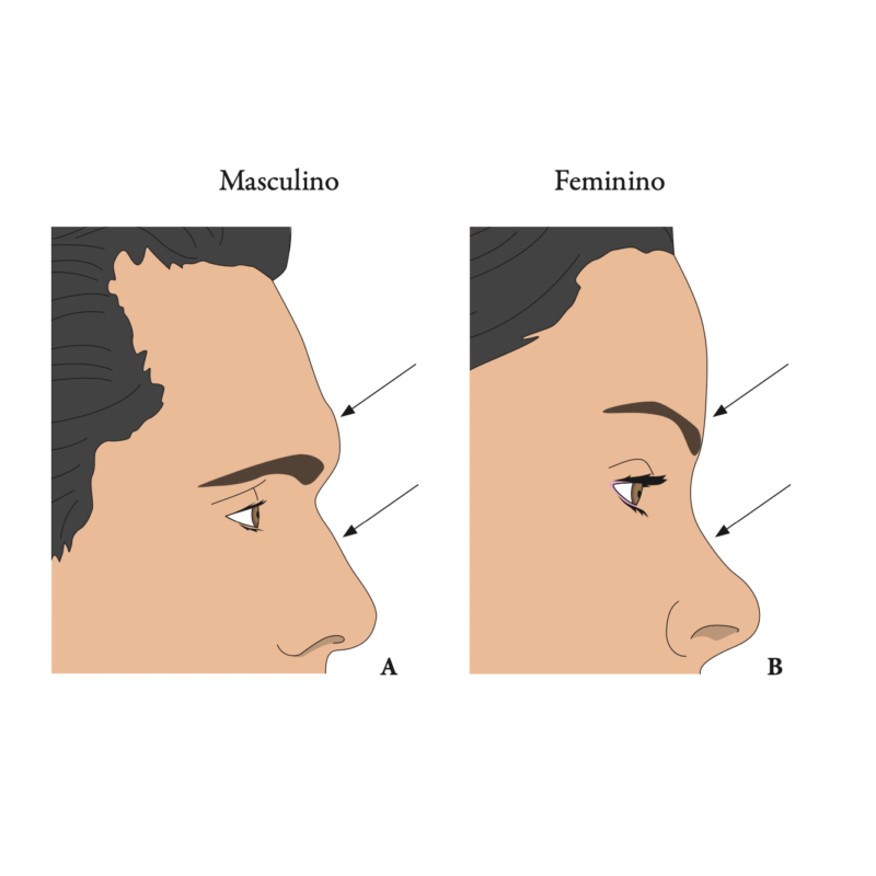 Consulta - Feminização Facial